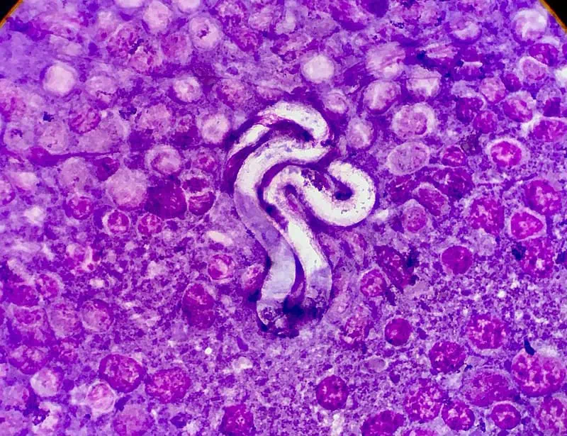 heartworm