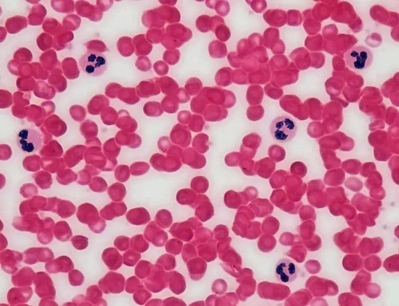 colored microscopic view of human blood leukocyte survey