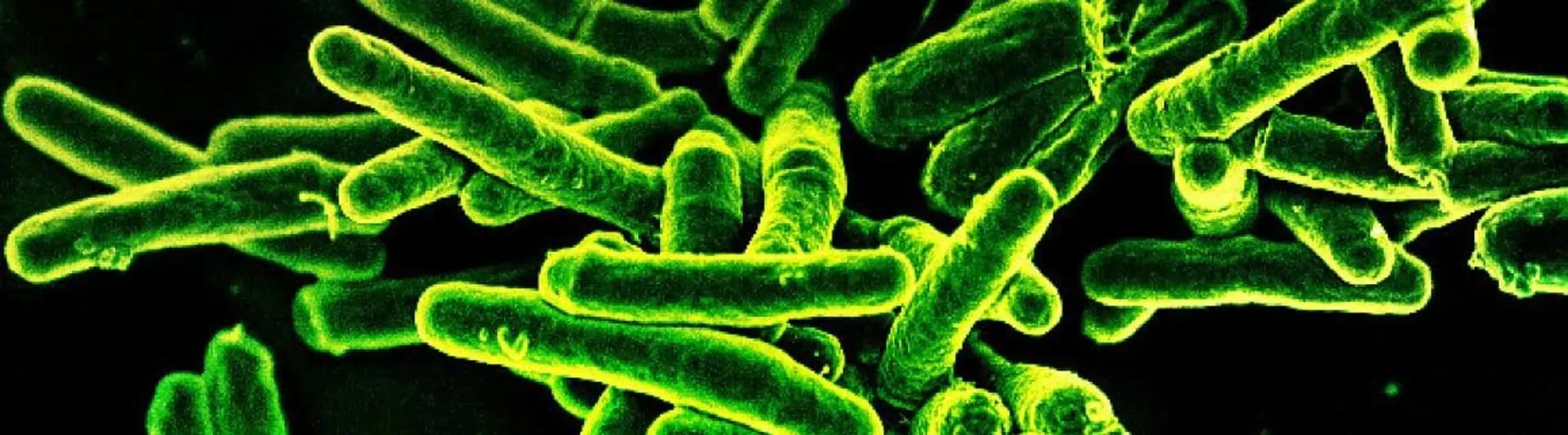 World Tuberculosis Day: Join The Fight Against TB